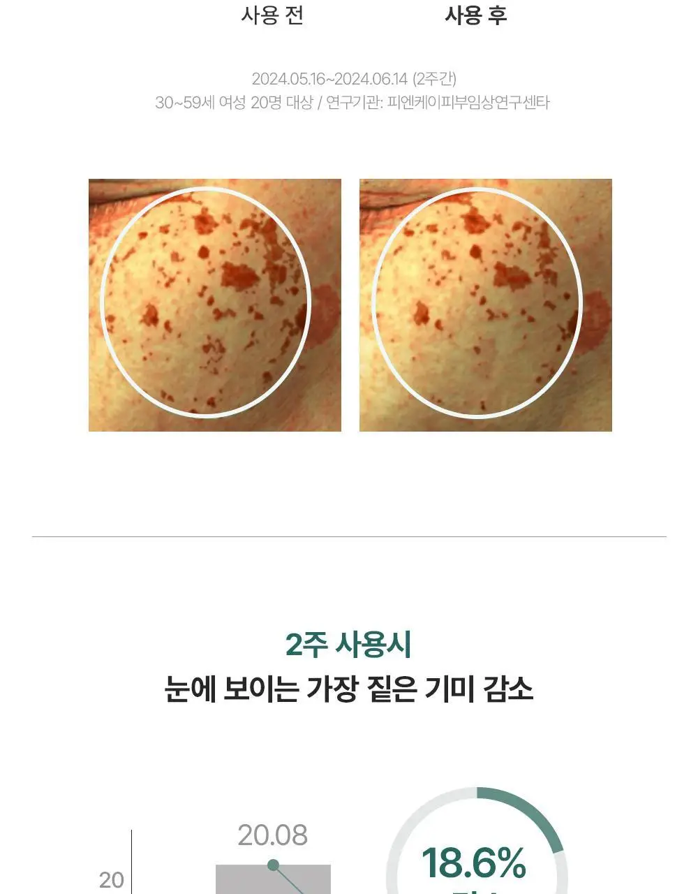 [잡티토닝/광채] 아렌시아 홀리 히솝 세럼 30 50g 기획 (+스파츌라 팩브러쉬) 상세페이지 18